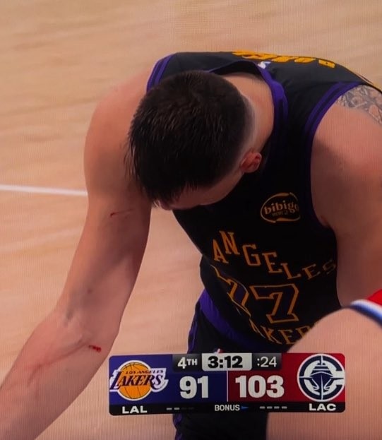 开云中国网站-谁抓的~东契奇罚球时看向手臂 好几道伤口&amp;血迹斑斑